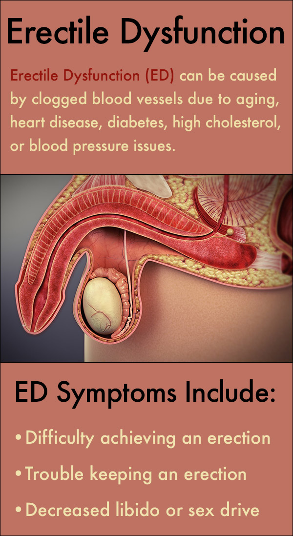 what is erectile dysfunction ed symptoms
